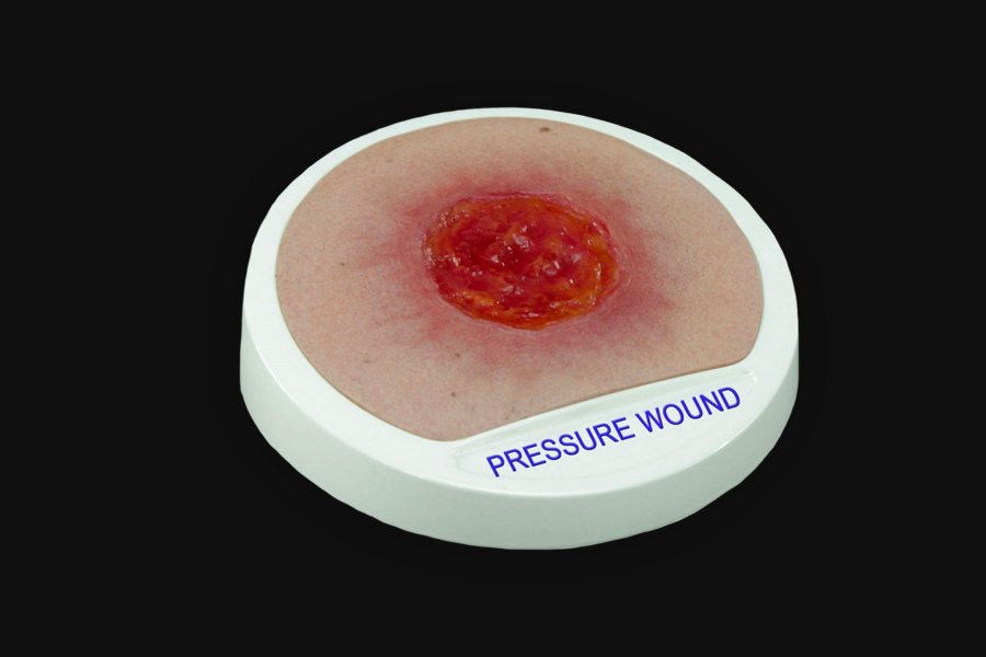 pressurewoundprop